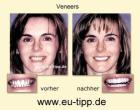 ZAHN-Reise CZ -günstiger als Ungarn- Implantate 490 Euro